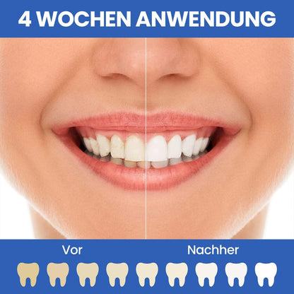 Oclean Find Duo Set Elektrische Zahnbürste, 2er Electric Toothbrush mit 5 Modi, Schallzahnbürste mit 180 Tage Akkulaufzeit, Wasserdicht nach IPX7- Pink & blau